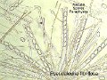 Pseudaleuria fibrillosa-amf2207-micro